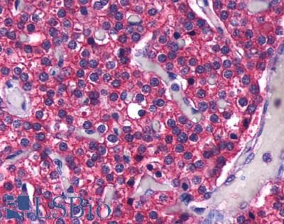 PathPlus™ CASR/Calcium Sensing Receptor Antibody (N-Terminus)