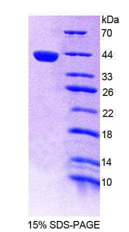 Mouse ICSBP / IRF8 Protein (Recombinant His-T7)