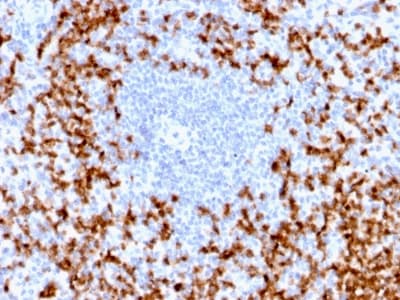 MMP9 / Gelatinase B Antibody (aa 603-614, clone MMP9/2025R)