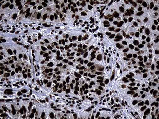 HNRNPH1 / hnRNP H Antibody (clone OTI2D11, Carrier-free)