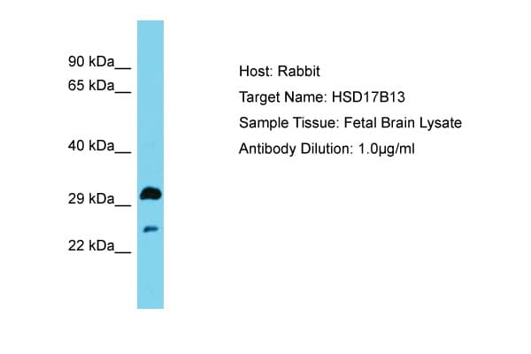 HSD17B13 Antibody (aa91-140, Biotin)