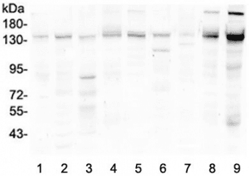 HDAC5 Antibody