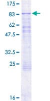 Human HSPC167 / CDK5RAP1 Protein (Recombinant GST)