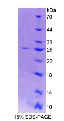 Human CTSO Protein (Recombinant His-T7, N-terminus)