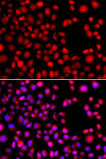 Polyclonal Rabbit anti-Human HLX1 / HLX Antibody (IHC, IF, WB)