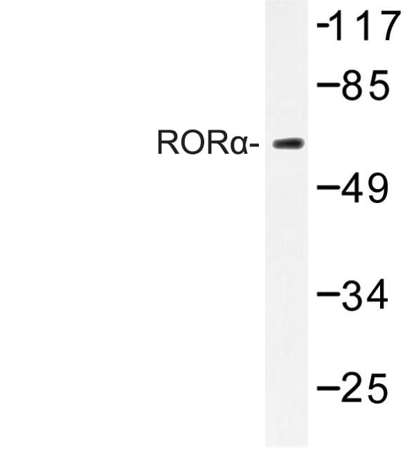 Polyclonal Rabbit anti-Human RORA / ROR Alpha Antibody (Gly41, IHC, IF, WB)