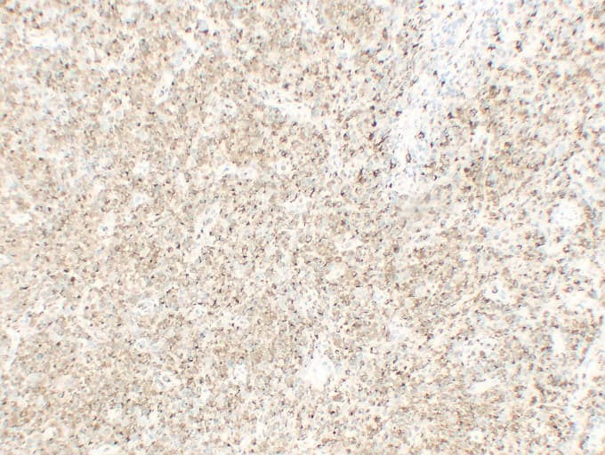 CD68 Antibody (clone ABT-CD68)