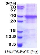 Human UBE2R2 Protein (Recombinant His)