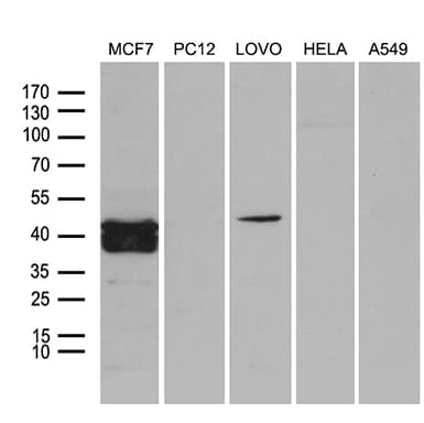 Monoclonal Mouse anti-Human FOSL2 / FRA-2 Antibody (clone OTI1C6, aa110-326, WB)