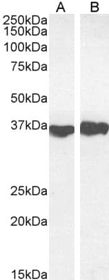 Polyclonal Goat anti-Human GAPDH Antibody (aa92-103, IHC, IF, WB)