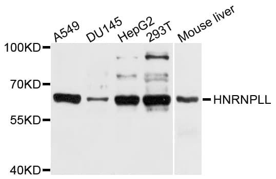 HnRNPLL / HNRPLL Antibody