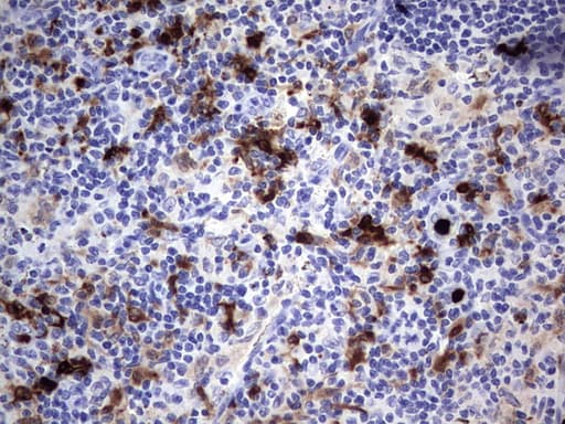 S100A9 / MRP14 Antibody (clone OTI3C12)