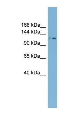 TTC17 Antibody (aa107-156)