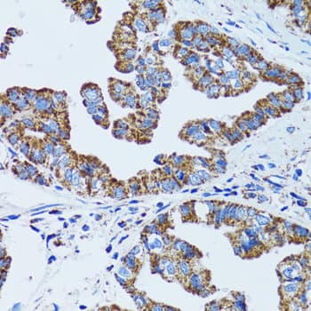 Polyclonal Rabbit anti-Human Gastric Inhibitory Peptide Antibody (IHC, IF, WB)