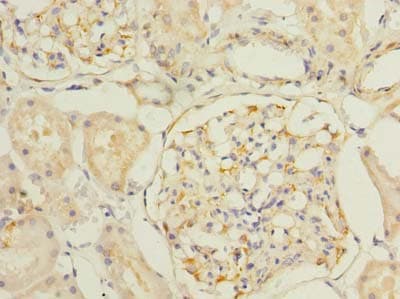 Polyclonal Rabbit anti-Human SLC25A33 Antibody (IHC)