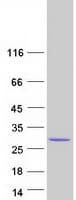 Human PCTP Protein (Recombinant Myc-DDK (Flag))