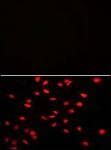 Polyclonal Rabbit anti-Human PI4K2A / PI4KII Antibody (aa1-30, IHC, IF, WB)