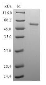 Human RD / PHYH Protein (Recombinant GST, N-terminus)