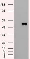 KRT8 / CK8 / Cytokeratin 8 Antibody (clone OTI1B12)