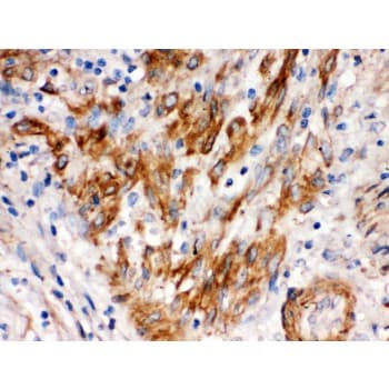 SFRP4 Antibody (aa22-303)