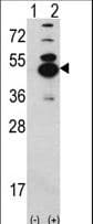 Polyclonal Rabbit anti-Human CAMK1D Antibody (aa39-69, WB)