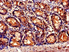 Polyclonal Rabbit anti-Human TNFAIP1 Antibody (IHC, IF)