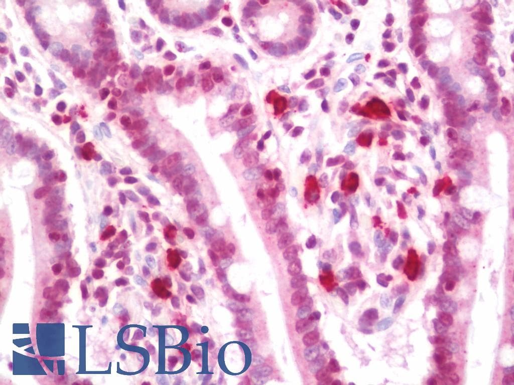 IHC-plus™ PSK / SEZ6L2 Antibody (aa879-907)