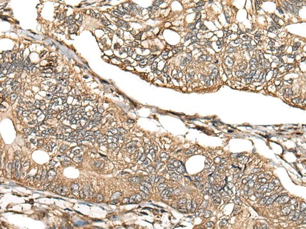 CA11 / Carbonic Anhydrase XI Antibody
