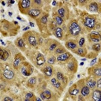 IHC-plus™ Polyclonal Rabbit anti-Human RAF1 / RAF Antibody (C-Terminus, IHC, IF, WB)