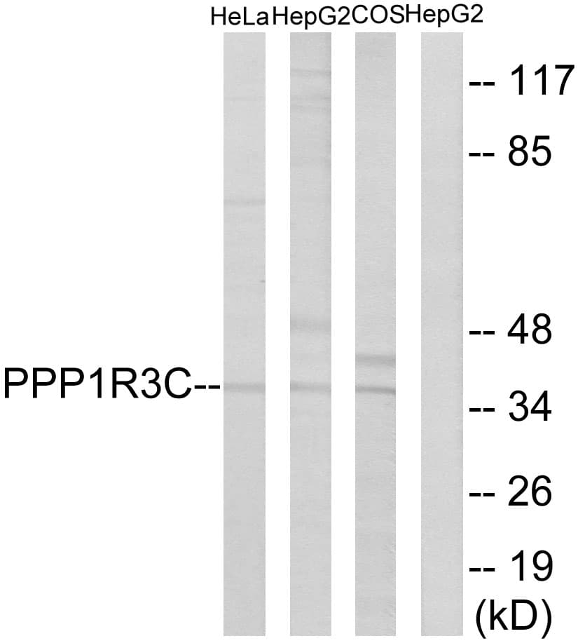 PPP1R3C / PTG Antibody (aa44-93)