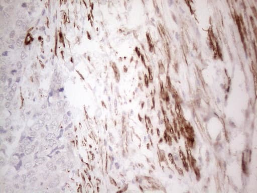 Monoclonal Mouse anti-Human SETD8 / SET8 Antibody (clone OTI3G9, IHC, WB)