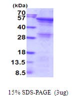 Human ANGPTL2 / ARP2 Protein (Recombinant His)