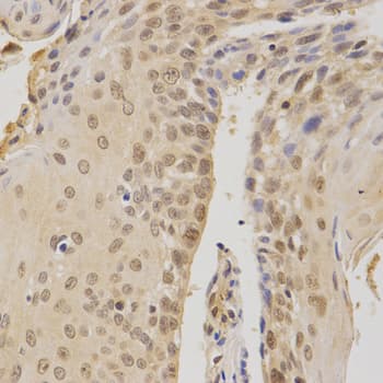 Polyclonal Rabbit anti-Human BMI1 / PCGF4 Antibody (IHC, IF, WB)