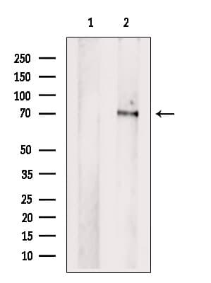 PCK2 / PEPCK Antibody