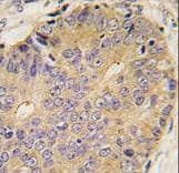 BMP15 Antibody (aa241-271)
