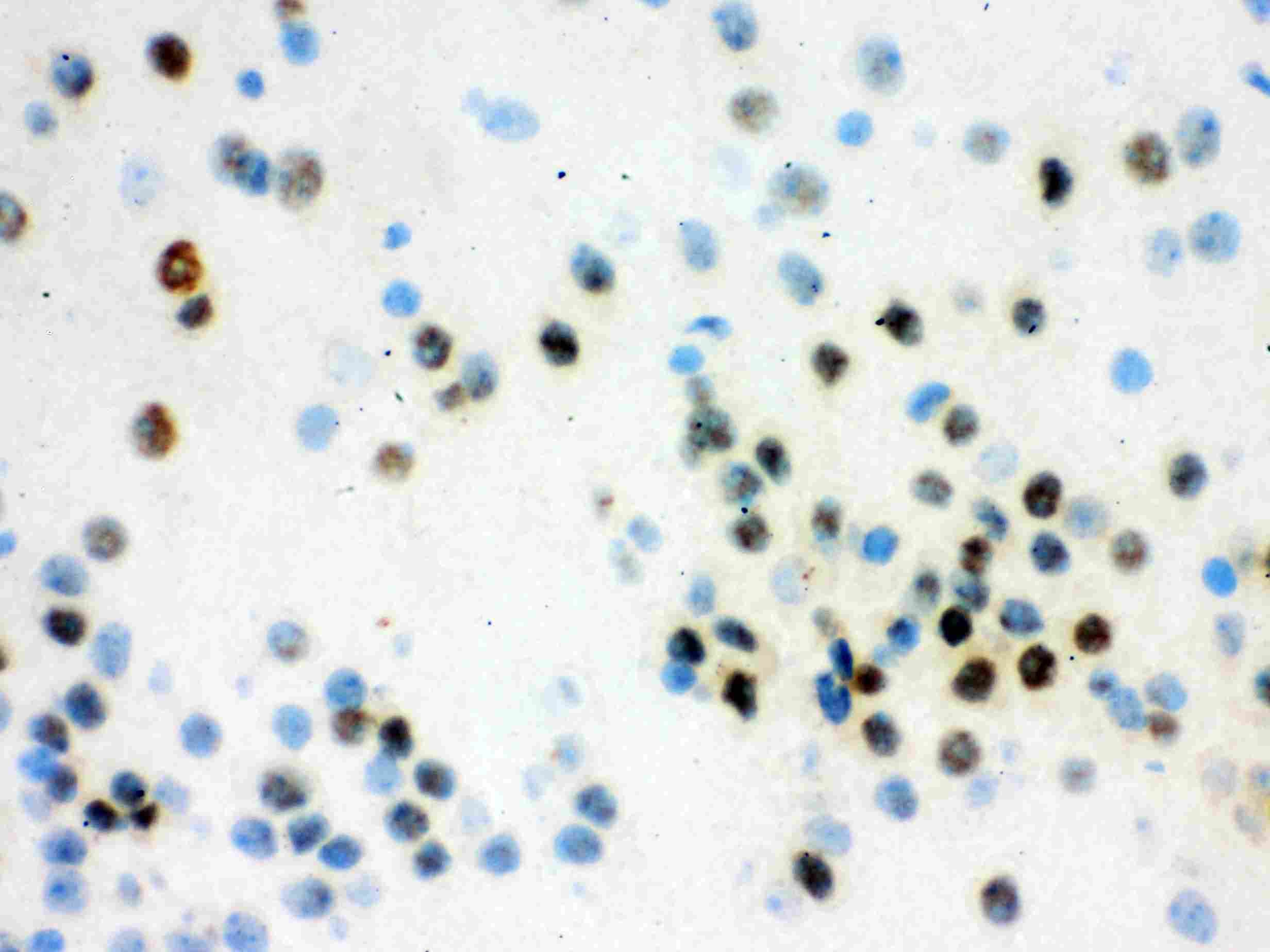 Polyclonal Rabbit anti-Human VCP Antibody (IHC, WB)