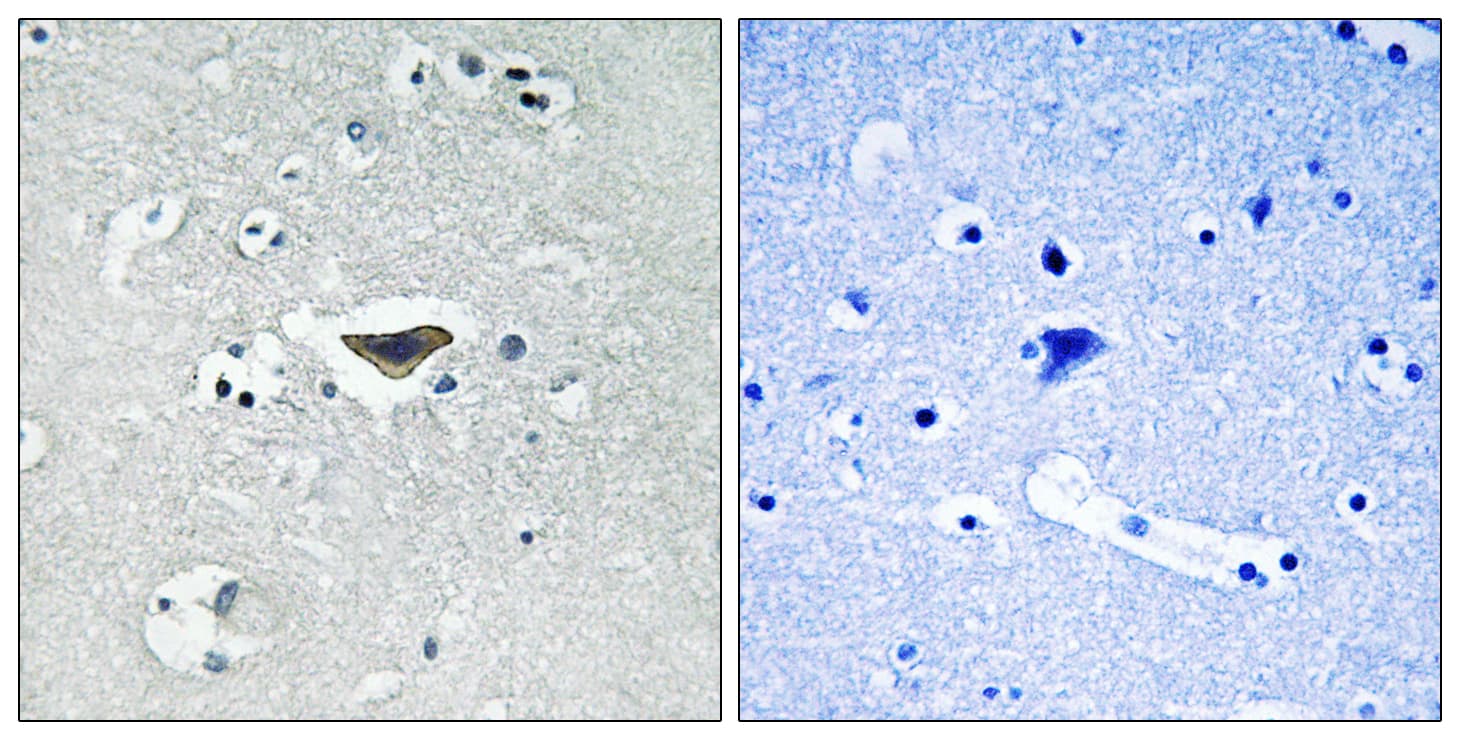 RASGRF1 / CDC25 Antibody (phospho-Ser916)