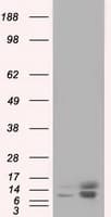 Monoclonal Mouse anti-Human PFN1 / Profilin 1 Antibody (clone OTI1D5, IHC, IF, WB)
