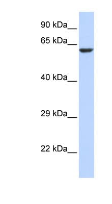 Polyclonal Rabbit anti-Human KCNV1 / Kv8.1 Antibody (aa36-85, WB)