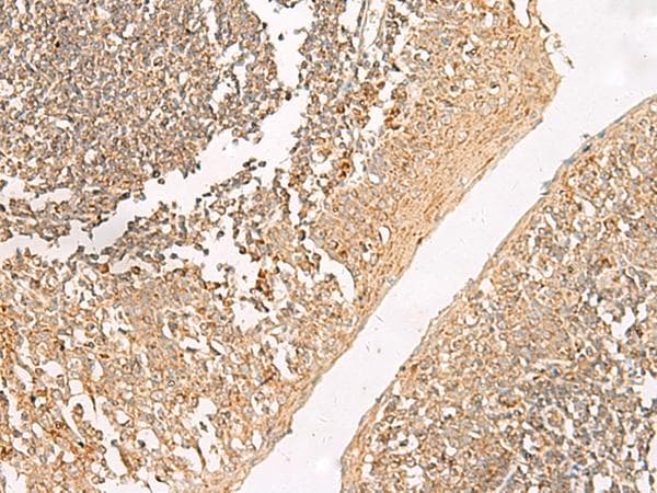 GRIK5 / KA2 Antibody