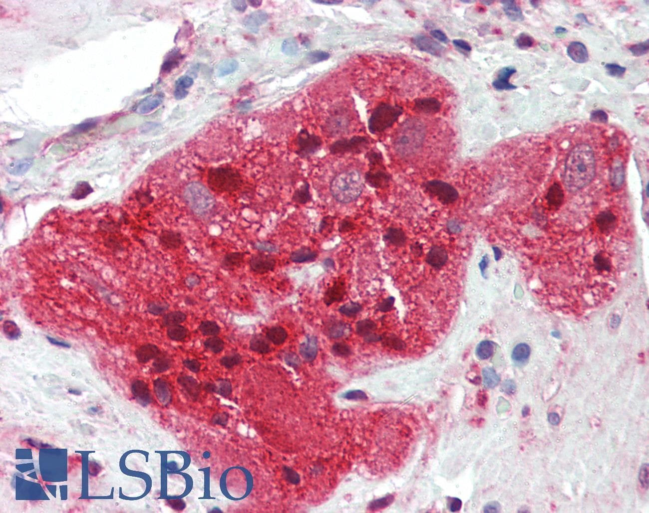IHC-plus™ SCG10 / STMN2 Antibody (aa2-11)