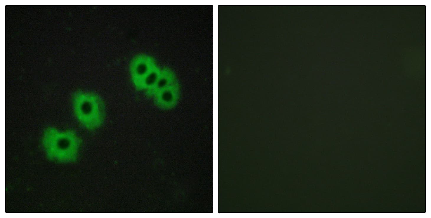 P2RY14 / GPR105 Antibody (aa146-195)