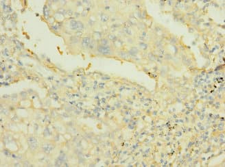 PTPRJ / CD148 Antibody