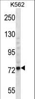 THNSL1 Antibody (aa694-722)