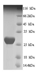 Human SLC26A5 Protein (Recombinant 6His, N-terminus)