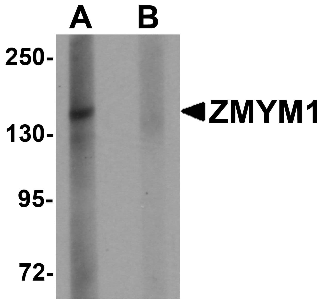 IHC-plus™ ZMYM1 Antibody