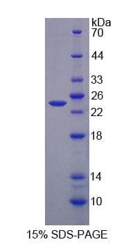 Human AGXT / SPT Protein (Recombinant His-T7, N-terminus)