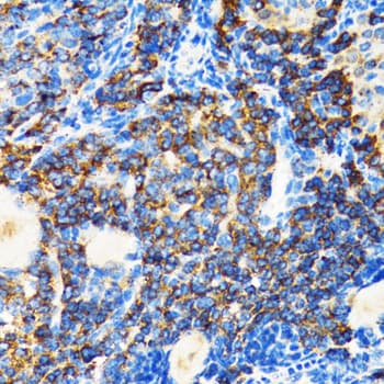 Polyclonal Rabbit anti-Human FGFR2 / FGF Receptor 2 Antibody (IHC, IF, WB)