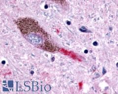 PathPlus™ P2Y13 / P2RY13 Antibody (Cytoplasmic Domain)