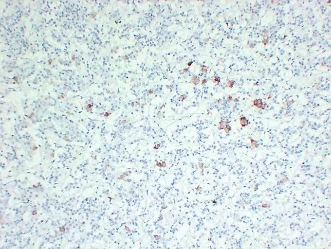 TSHB / TSH-Beta Antibody (clone ABT-TSH)